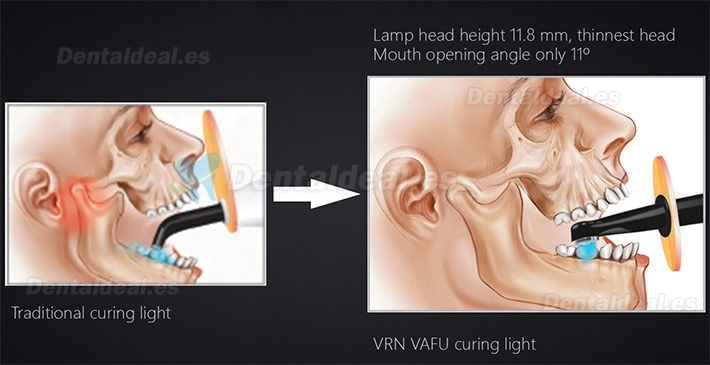 VRN Vafu Dental 5W LED Lámpara de Polimerización Inalámbrica 2500MW con Detector de Caries & Radiómetro